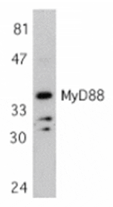 Western blot - MYD88 Antibody from Signalway Antibody (24065) - Antibodies.com
