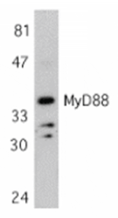 Western blot - MYD88 Antibody from Signalway Antibody (24065) - Antibodies.com
