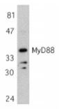 Western blot - MYD88 Antibody from Signalway Antibody (24065) - Antibodies.com
