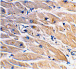 Immunohistochemistry - MYD88 Antibody from Signalway Antibody (24065) - Antibodies.com