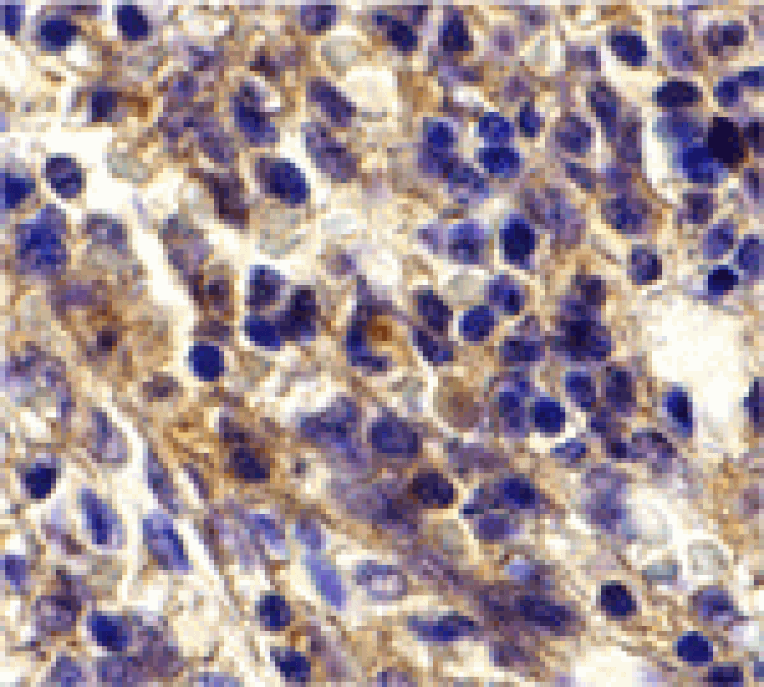 Immunohistochemistry - Bonzo Antibody from Signalway Antibody (24083) - Antibodies.com