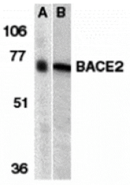 Western blot - BACE2 Antibody from Signalway Antibody (24098) - Antibodies.com