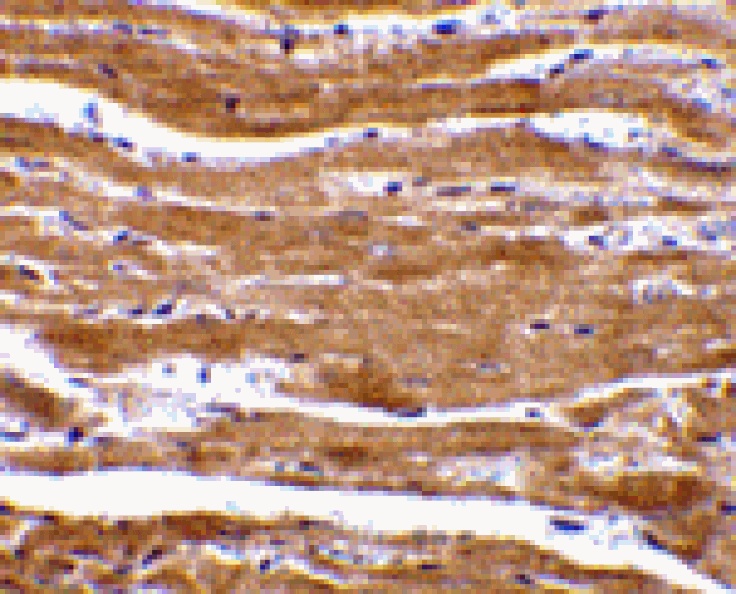 Immunohistochemistry - BACE2 Antibody from Signalway Antibody (24098) - Antibodies.com