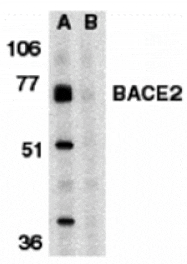 Western blot - BACE2 Antibody from Signalway Antibody (24099) - Antibodies.com