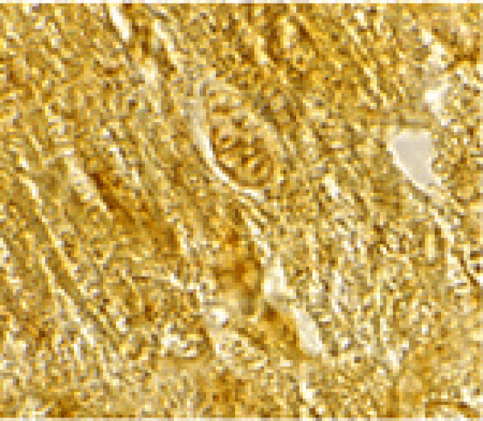 Immunohistochemistry - BACE2 Antibody from Signalway Antibody (24099) - Antibodies.com