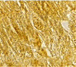 Immunohistochemistry - BACE2 Antibody from Signalway Antibody (24099) - Antibodies.com