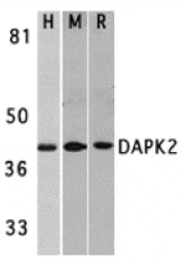 Western blot - DAPK2 Antibody from Signalway Antibody (24118) - Antibodies.com
