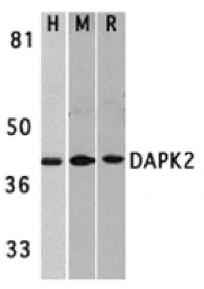 Western blot - DAPK2 Antibody from Signalway Antibody (24118) - Antibodies.com