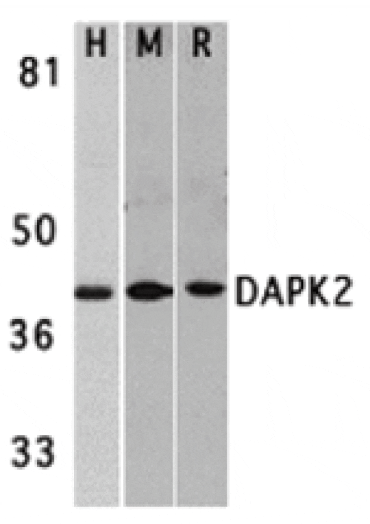 Western blot - DAPK2 Antibody from Signalway Antibody (24118) - Antibodies.com
