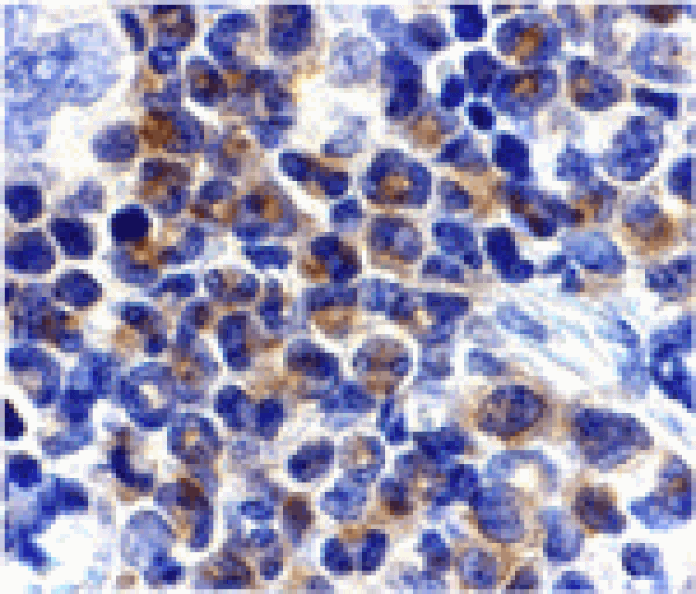 Immunohistochemistry - DAPK2 Antibody from Signalway Antibody (24118) - Antibodies.com