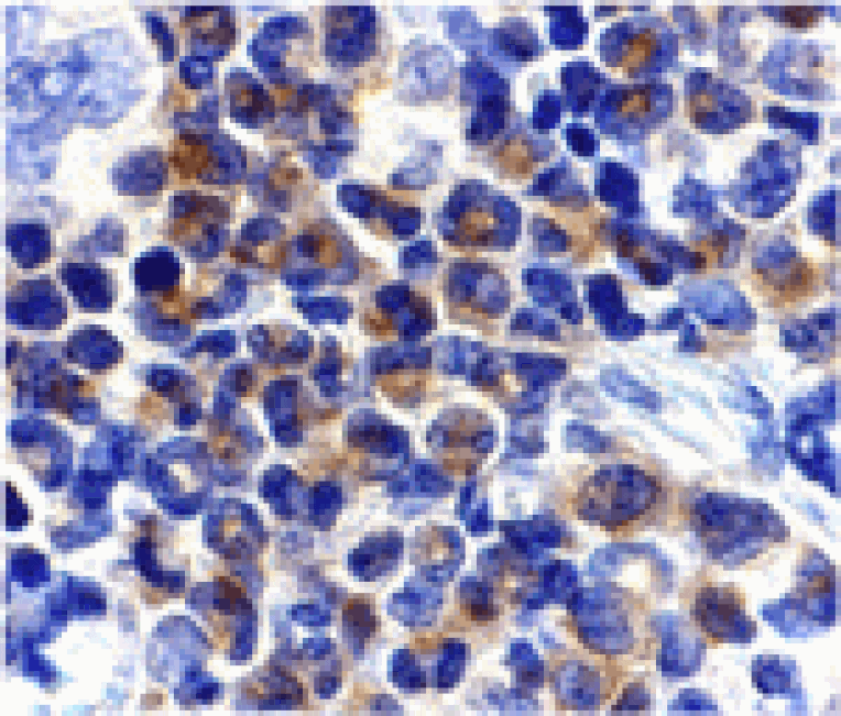 Immunohistochemistry - DAPK2 Antibody from Signalway Antibody (24118) - Antibodies.com