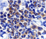 Immunohistochemistry - DAPK2 Antibody from Signalway Antibody (24118) - Antibodies.com