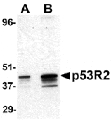 Western blot - p53R2 Antibody from Signalway Antibody (24129) - Antibodies.com