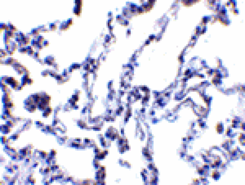 Immunohistochemistry - p53R2 Antibody from Signalway Antibody (24129) - Antibodies.com