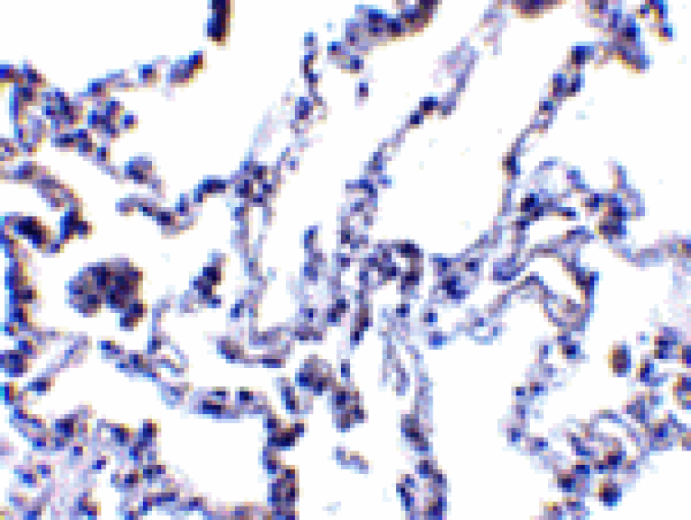 Immunohistochemistry - p53R2 Antibody from Signalway Antibody (24129) - Antibodies.com