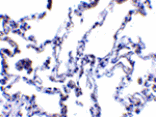 Immunohistochemistry - p53R2 Antibody from Signalway Antibody (24129) - Antibodies.com