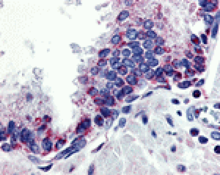 Immunohistochemistry - APRIL Antibody from Signalway Antibody (24136) - Antibodies.com