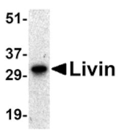 Western blot - Livin Antibody from Signalway Antibody (24156) - Antibodies.com