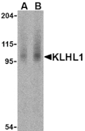 Western blot - KLHL1 Antibody from Signalway Antibody (24165) - Antibodies.com