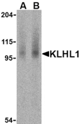 Western blot - KLHL1 Antibody from Signalway Antibody (24165) - Antibodies.com