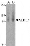 Western blot - KLHL1 Antibody from Signalway Antibody (24165) - Antibodies.com