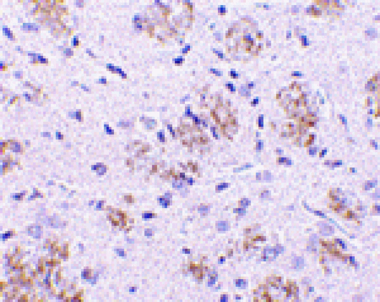 Immunohistochemistry - KLHL1 Antibody from Signalway Antibody (24165) - Antibodies.com