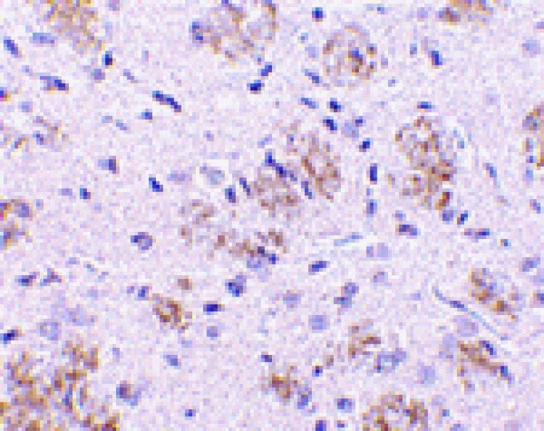 Immunohistochemistry - KLHL1 Antibody from Signalway Antibody (24165) - Antibodies.com