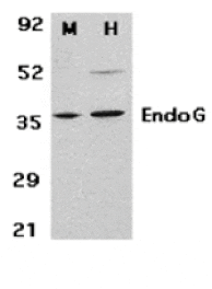 Western blot - EndoG Antibody from Signalway Antibody (24172) - Antibodies.com