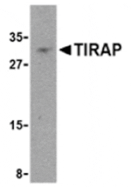 Western blot - TIRAP Antibody from Signalway Antibody (24200) - Antibodies.com