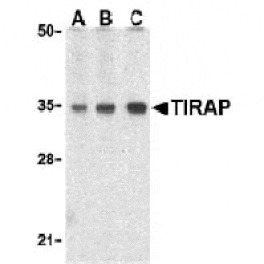 Western blot - TIRAP Antibody from Signalway Antibody (24201) - Antibodies.com