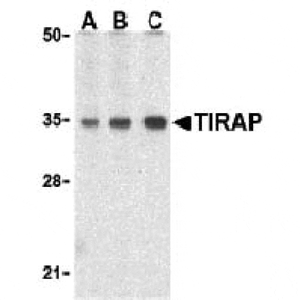Western blot - TIRAP Antibody from Signalway Antibody (24201) - Antibodies.com