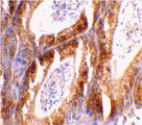 Immunohistochemistry - Bcl-G Antibody from Signalway Antibody (24203) - Antibodies.com