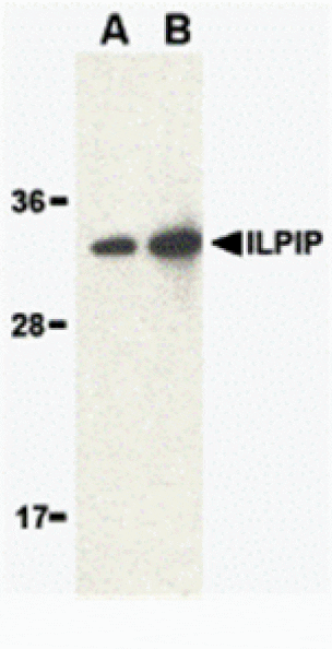 Western blot - ILPIP Antibody from Signalway Antibody (24210) - Antibodies.com