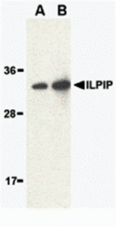 Western blot - ILPIP Antibody from Signalway Antibody (24210) - Antibodies.com