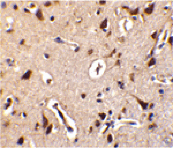 Immunohistochemistry - ILPIP Antibody from Signalway Antibody (24210) - Antibodies.com