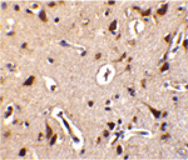 Immunohistochemistry - ILPIP Antibody from Signalway Antibody (24210) - Antibodies.com
