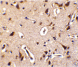 Immunohistochemistry - ILPIP Antibody from Signalway Antibody (24210) - Antibodies.com