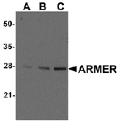 Western blot - ARMER Antibody from Signalway Antibody (24238) - Antibodies.com