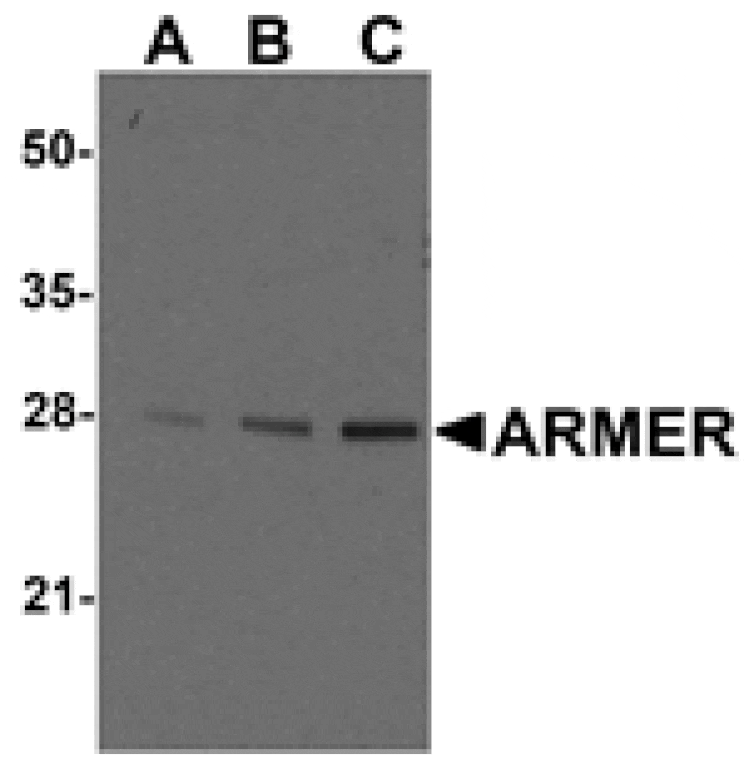 Western blot - ARMER Antibody from Signalway Antibody (24238) - Antibodies.com