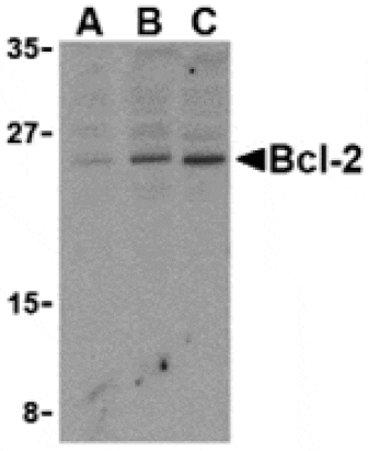 Western blot - Bcl-2 Antibody from Signalway Antibody (24245) - Antibodies.com