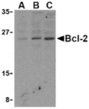 Western blot - Bcl-2 Antibody from Signalway Antibody (24245) - Antibodies.com