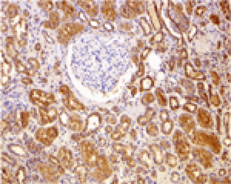 Immunohistochemistry - Bcl-2 Antibody from Signalway Antibody (24245) - Antibodies.com