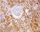 Immunohistochemistry - Bcl-2 Antibody from Signalway Antibody (24245) - Antibodies.com