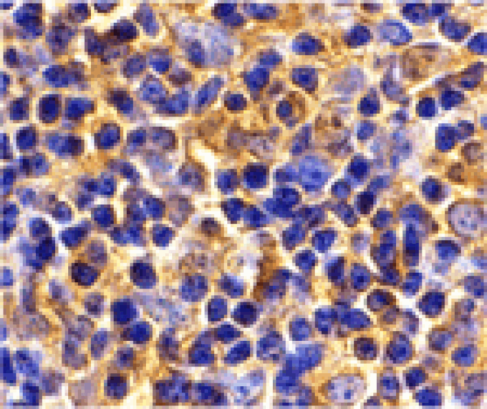 Immunohistochemistry - UBC13 Antibody from Signalway Antibody (24258) - Antibodies.com