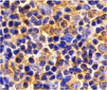 Immunohistochemistry - UBC13 Antibody from Signalway Antibody (24258) - Antibodies.com
