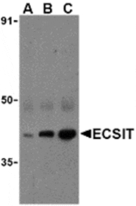 Western blot - ECSIT Antibody from Signalway Antibody (24260) - Antibodies.com