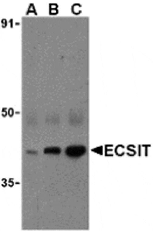 Western blot - ECSIT Antibody from Signalway Antibody (24260) - Antibodies.com