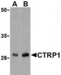 Western blot - CTRP1 Antibody from Signalway Antibody (24326) - Antibodies.com