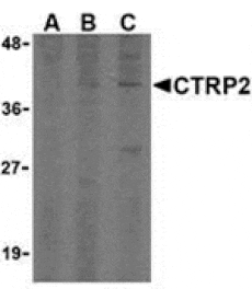 Western blot - CTRP2 Antibody from Signalway Antibody (24327) - Antibodies.com