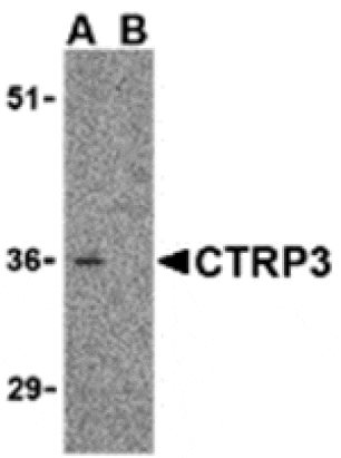 Western blot - CTRP3 Antibody from Signalway Antibody (24329) - Antibodies.com